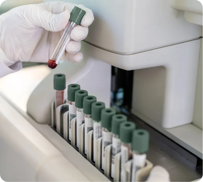 Receive Results and Optimise