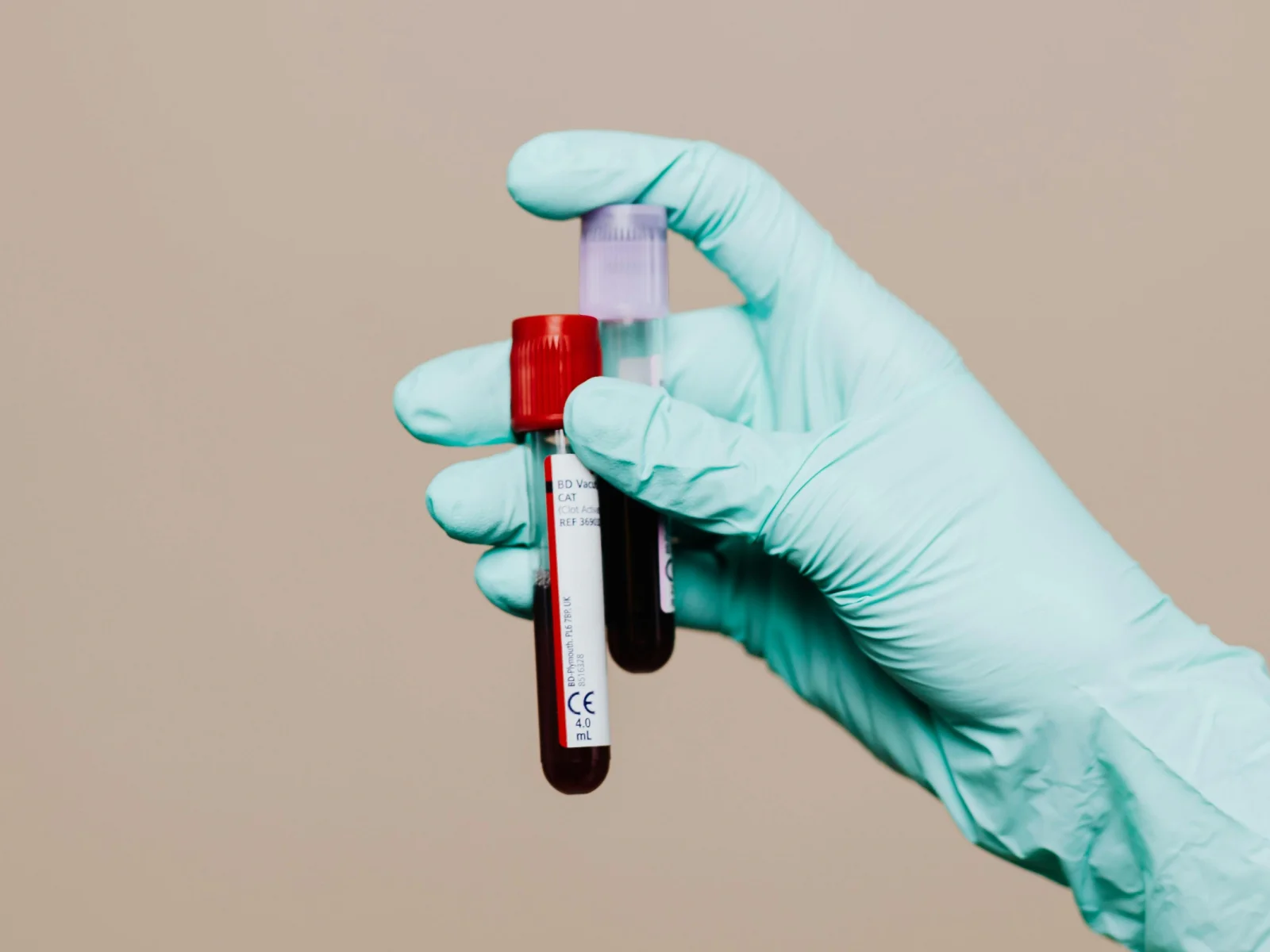 Why ApoB is changing heart risk assessment